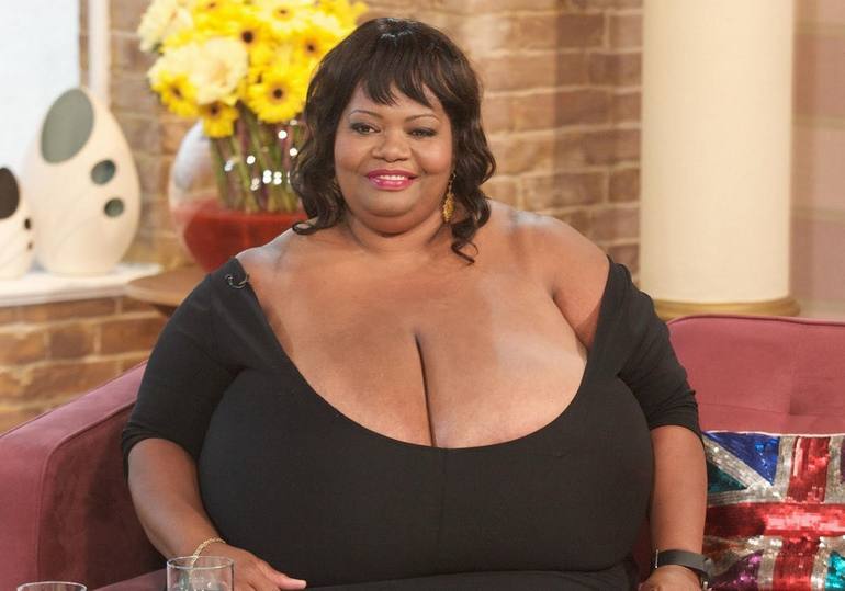 World’s largest natural breasts: Annie Hawkins-Turner